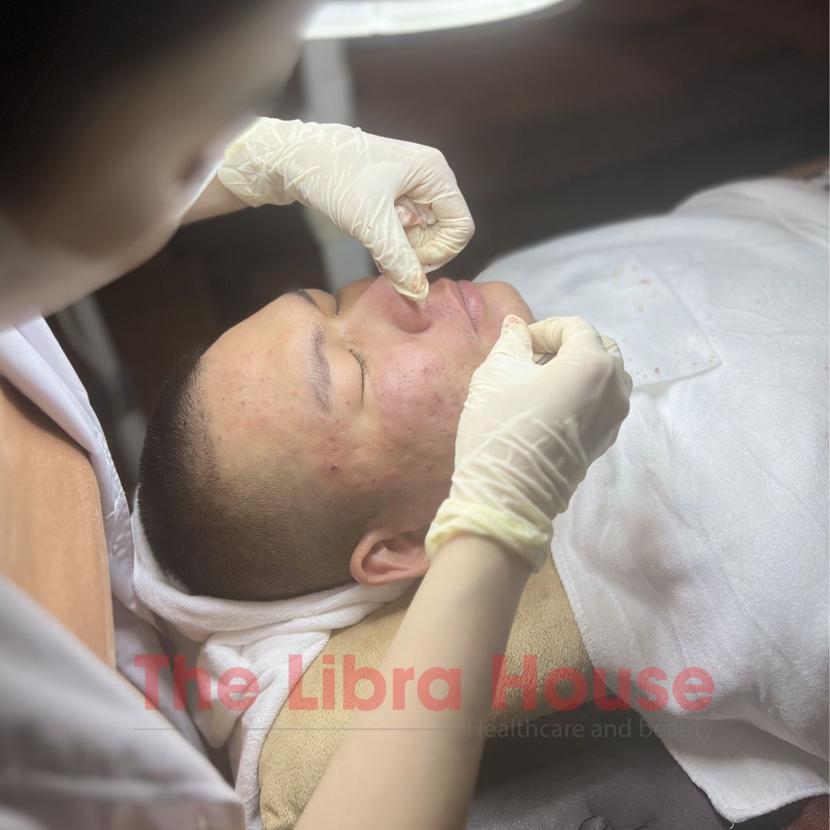 Chăm sóc da mụn nặng 3 Chăm sóc da mụn nặng 3