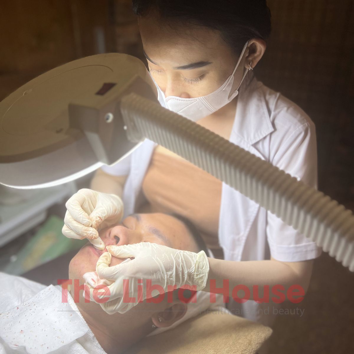 Chăm sóc da mụn nặng 5 Chăm sóc da mụn nặng 5