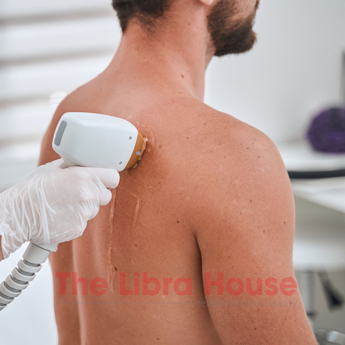 Triệt lông vùng lưng 6 Triệt lông vùng lưng 6